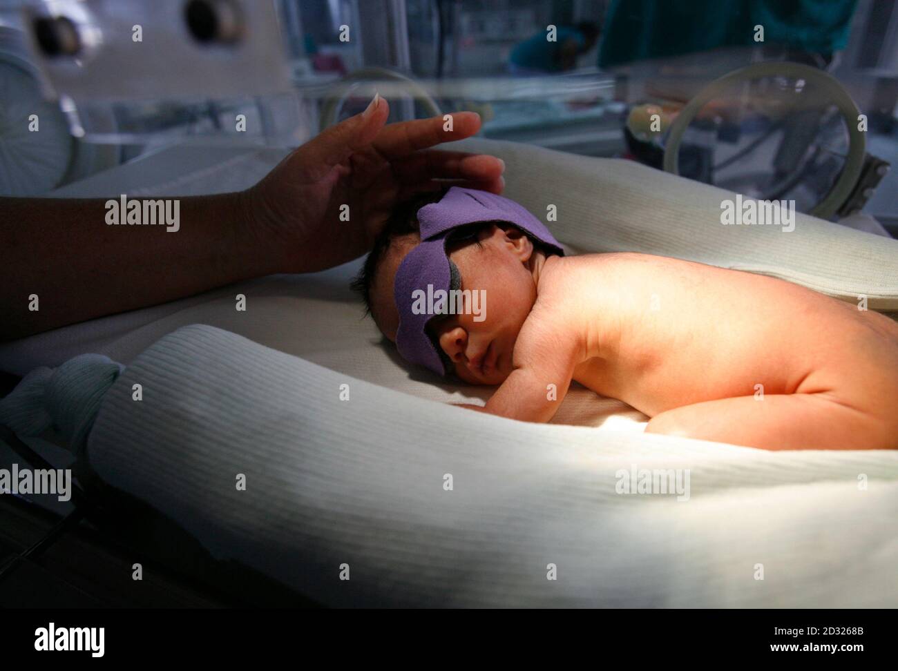 Phototherapy unit hires stock photography and images  Alamy