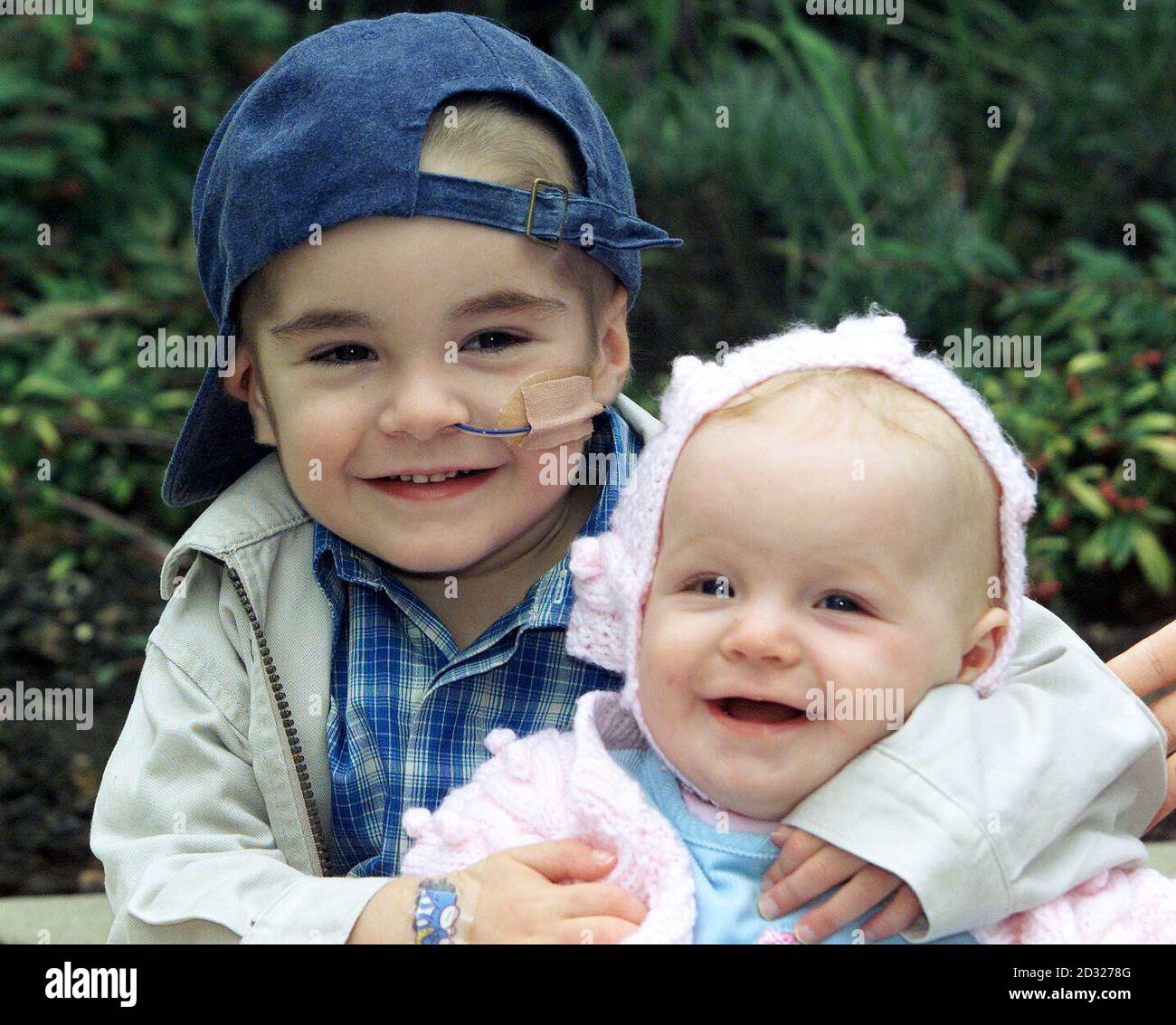 Tom Stretch, three, hugs his ten month-old sister, Hannah, who helped cure him of a potentially fatal disease, in Newcastle upon Tyne. * ..... Tom, from Mancot, Deeside, north Wales, was born with a defect of his white blood cells known as chronic granulomatous disease which left him unable to fight off germs, and was only cured when doctors at Newcastle General Hospital's specialist children's bone marrow transplant unitgave him a tranfusion of cord blood cells, harvested from the placenta of his mother, Joanne, shortly after she gave birth to Hannah. Doctors think that this is the first Stock Photo