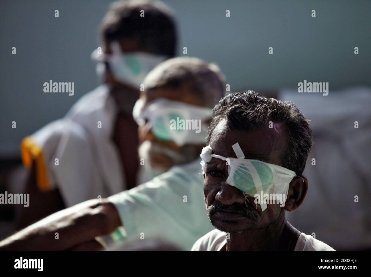 Cataract surgery india hires stock photography and images Alamy