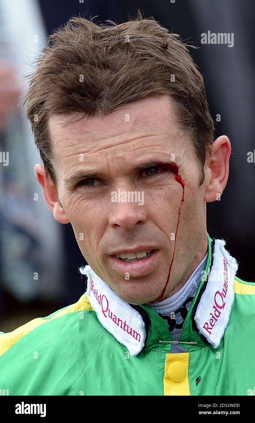 Jockey Graham Lee bleeds from a small facial cut an injury he sustained as he walked his mount Son Du Silence round the Paddock ahead of the Betfred Watch TV Pushes Handicap during John Smiths Northumberland Plate Day at Newcastle Racecourse, Newcastle. The jockey later went on to win the big Race The John Smiths Northumberland Plate on Tominator. Stock Photo