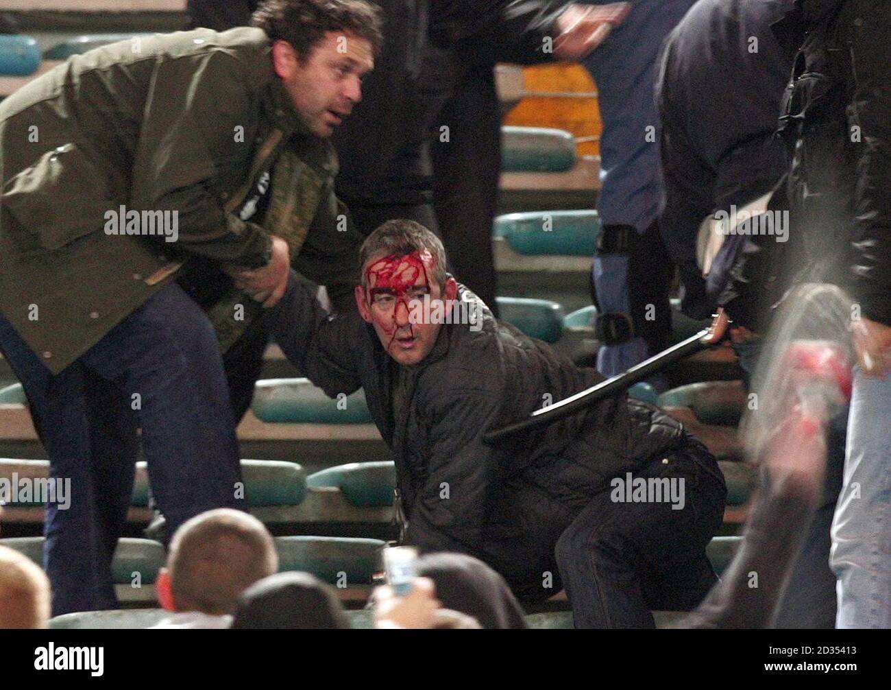 A Manchester United fan covered in blood after fighting broke out on the stands during the UEFA Champions League Quarter-final first leg match against Roma at the Olympic Stadium, Rome, Italy. Stock Photo