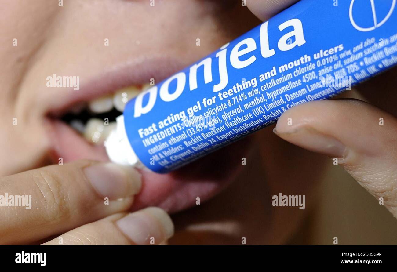 PICTURE POSED BY MODEL. A person using Bonjela. The Medicines and