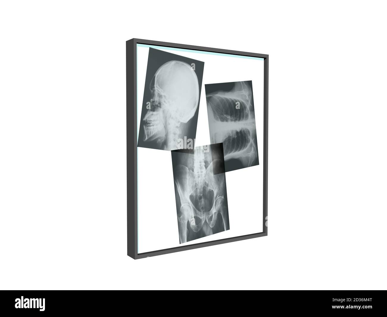 Fluorescent Lights Xrays at Jean Stclair blog