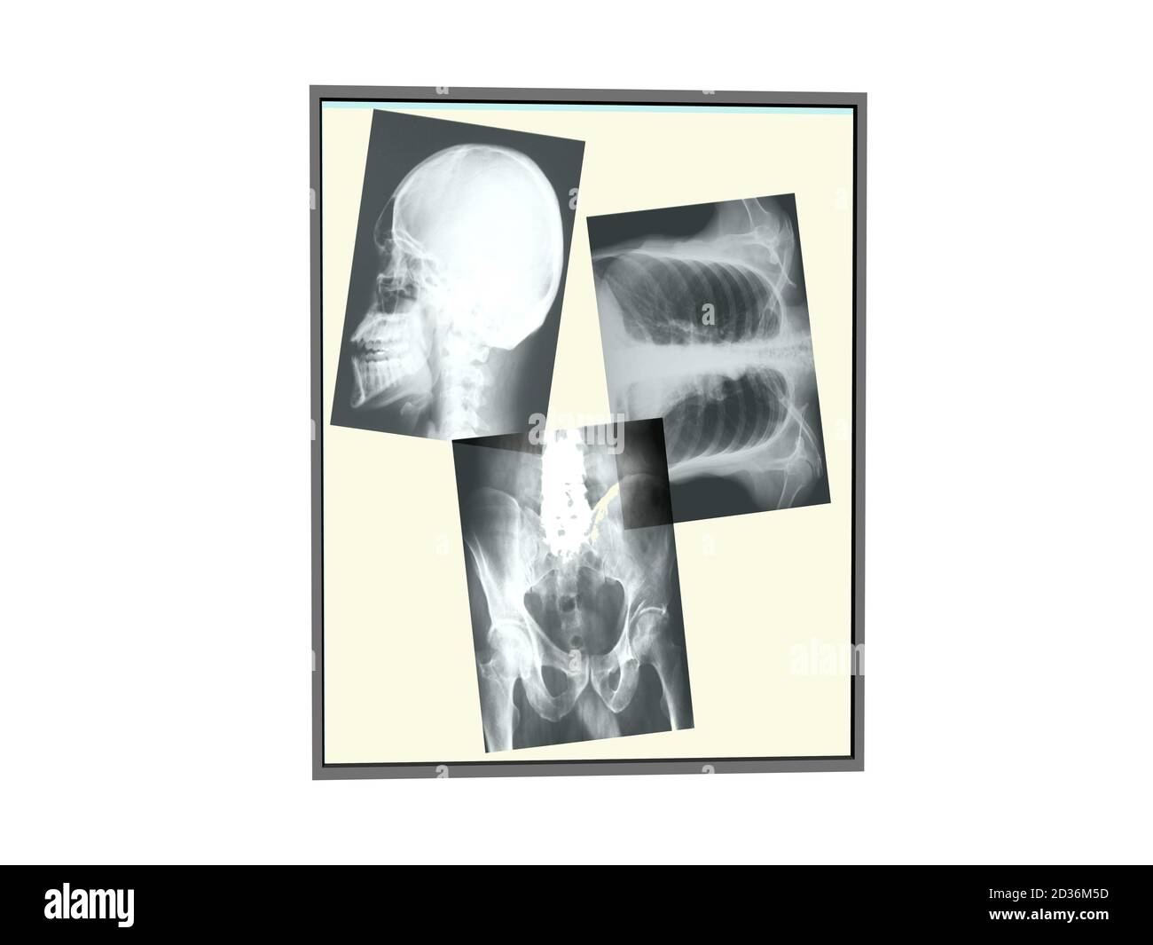 Fluorescent Lights Xrays at Jean Stclair blog