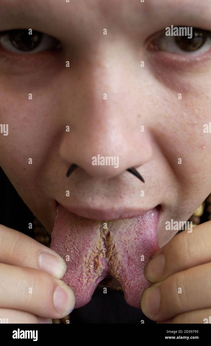 Ian, a 25-year-old tattoo artist, who had his tongue split as a form of  body art in New York, shows how it has healed on June 17, 2003. The latest  trend among