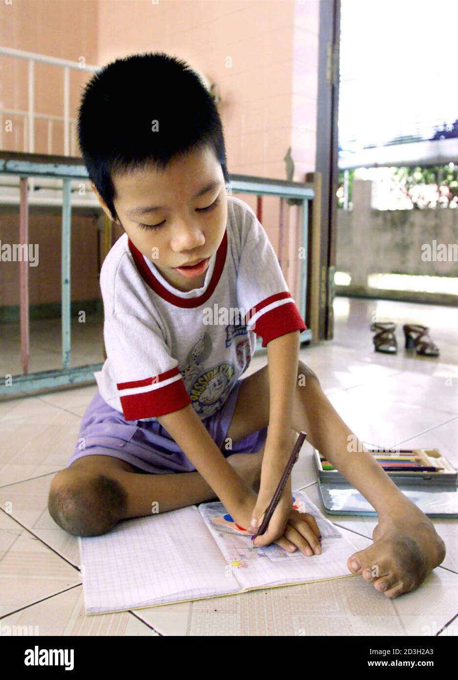 Nine Year Old Le Minh Chau Who Suffers From Birth Defects As A Result Of His Parents Exposure To The Defoliant Agent Orange Draws In His Notebook At The Tu Du Women S Hospital Nine Year Old Le Minh Chau Who Suffers From Birth Defects As A Result Of His Parents Exposure To The Defoliant Agent Orange Draws In His Notebook At The Tu Du Women S Hospital
