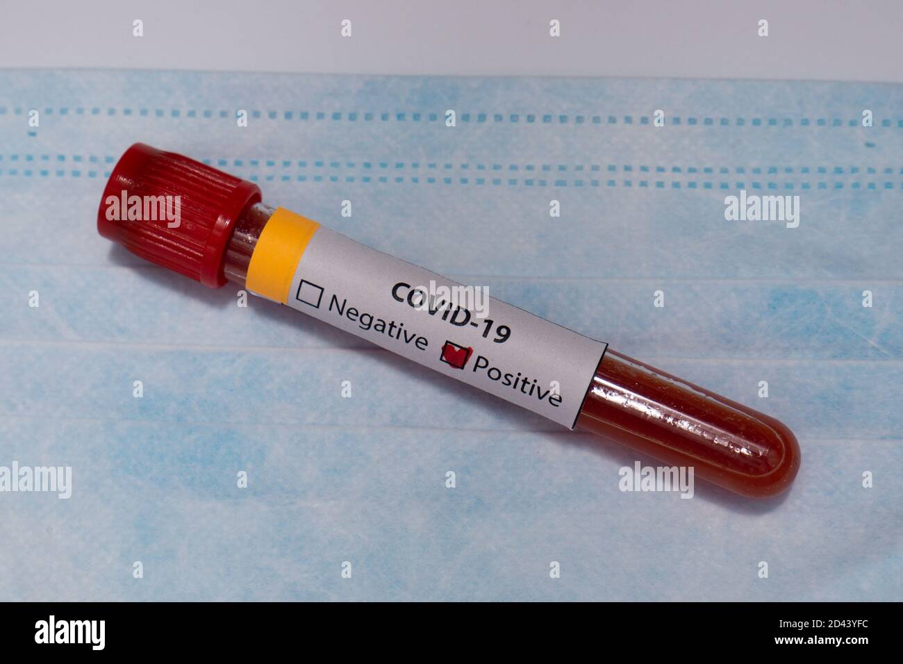 Blood positive test to coronavirus. Medical reseach, test-tubes with blood, medical mask. Coronavirus outbreak and influenza. 2019-nCoV, covid-19 Stock Photo