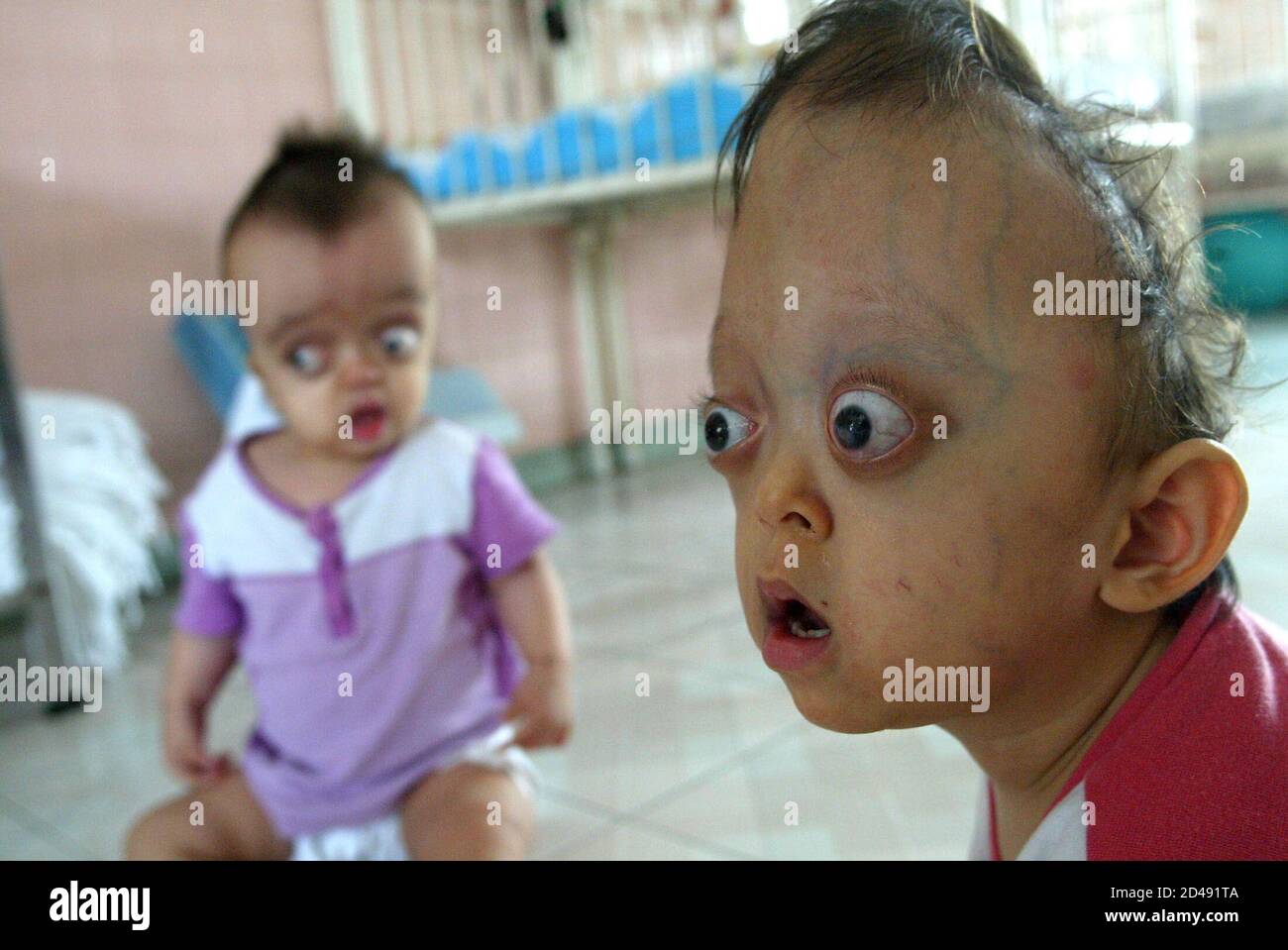 Children Born With Deformities Sit In The Peace Village At Tu Du Hopsital In Ho Chi Minh City February 3 04 The Hospital S Chef De Service Doctor Ng Thi Phuong Tan Suspects