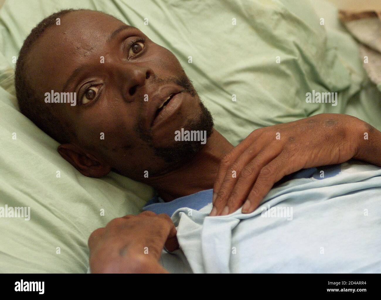 An Aids Victim In The Final Stage Of The Disease Stares Blindly In His Room At The Mashambanzou Care Trust In Harare May 24 01 Zimbabwe Has One Of The Highest Per An Aids Victim In The Final Stage Of The Disease Stares Blindly In His Room At The Mashambanzou Care Trust In Harare May 24 01 Zimbabwe Has One Of The Highest Per