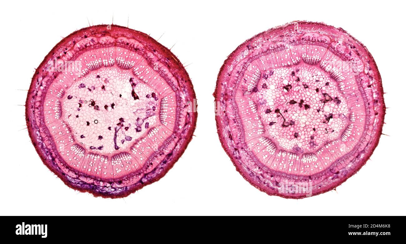 Elm twig, field elm, Ulmus procera, TS section, brightfield photomicrograph Stock Photo