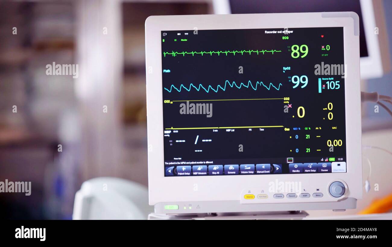 Ventilator monitor vital signs, EKG, ECG, Electrocardiographic operating  room, emergency room in the hospital, intensive therapy, treatment Stock  Photo - Alamy