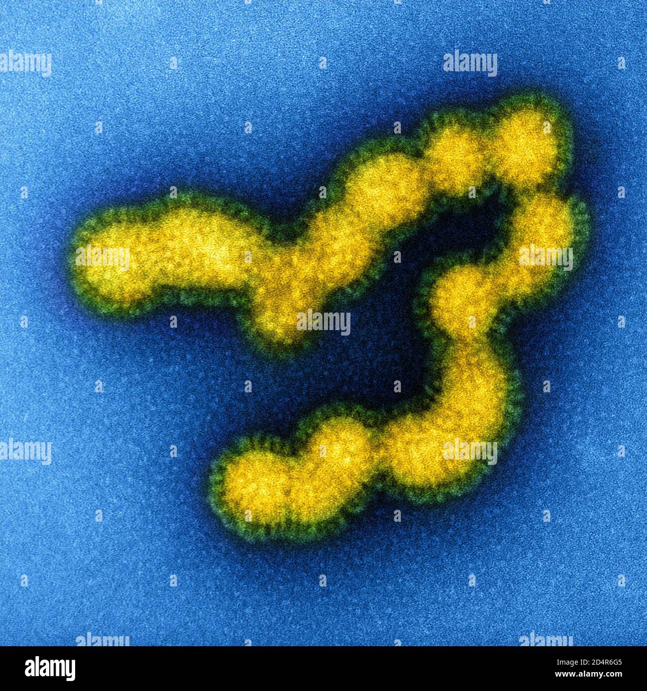 Swine Flu Strain Virus Particles Colorized transmission electron micrograph of negatively stained SW31 (swine strain) influenza virus particles. Credi Stock Photo