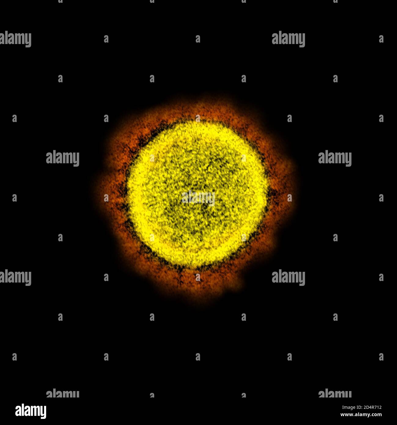 This transmission electron microscope image shows SARSCoV2—also known
