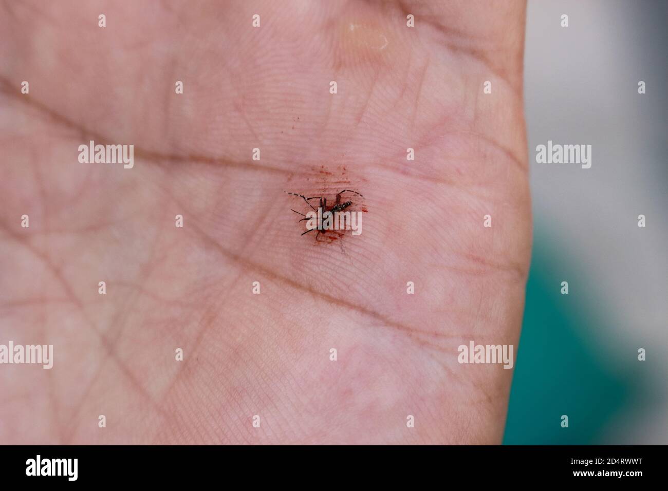 The remains of aedes aegypti that was slapped to death on the palm. Stock Photo