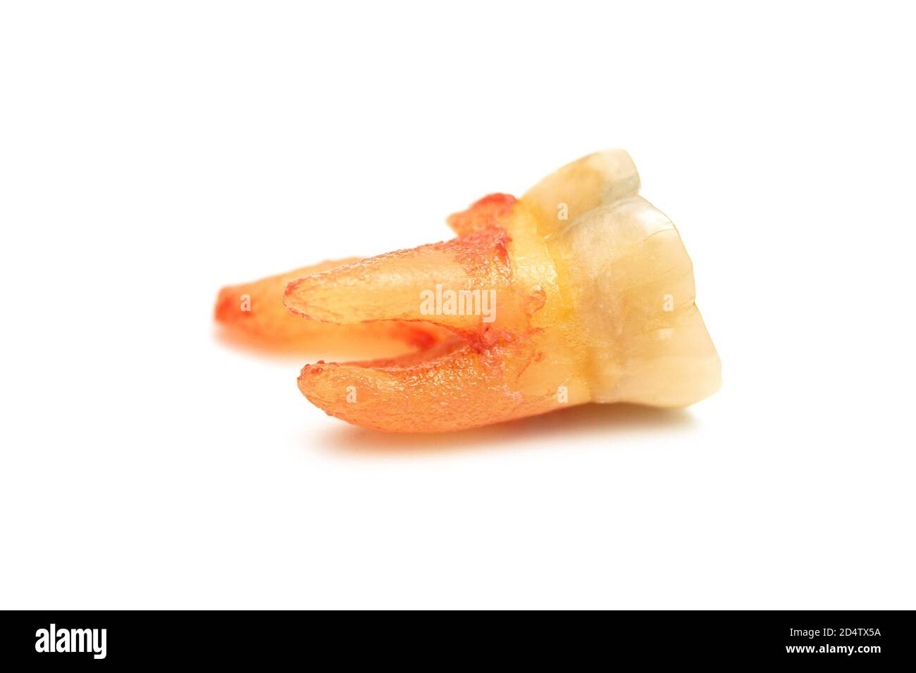 extracted caries tooth isolated on white background close-up Stock Photo