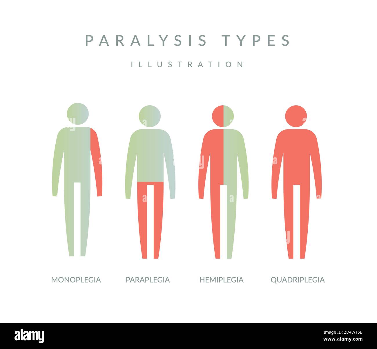 Types of Paralysis - Illustration as EPS 10 File Stock Vector