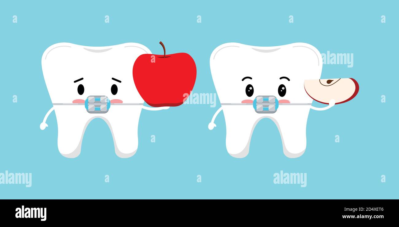 Cute white tooth with dental braces and apple icon set Stock Vector ...