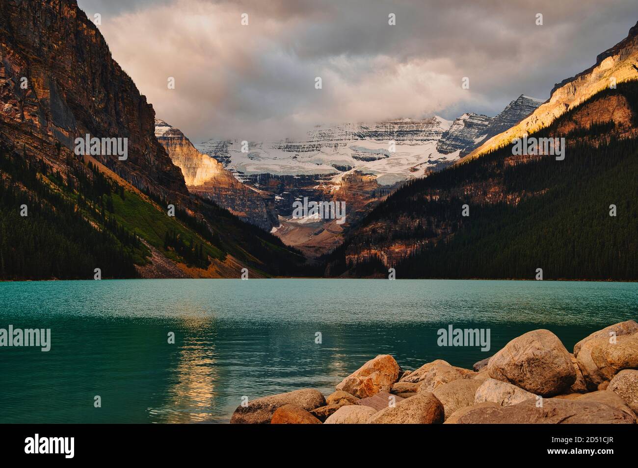 Beautiful Lake Louise Stock Photo - Alamy