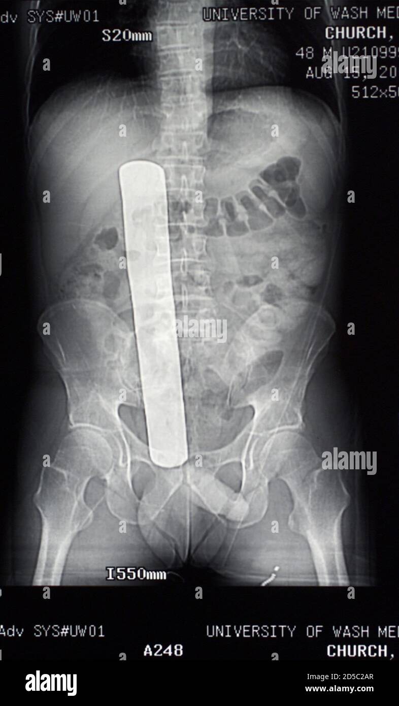 Post surgical pain hi-res stock photography and images - Alamy