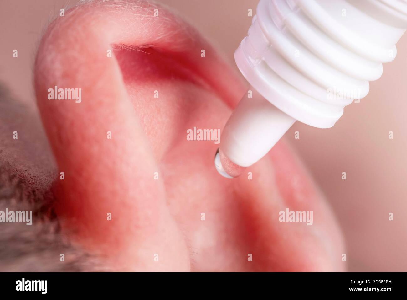 Ear drops fall from the plastic container into the baby's ear. Macro ...