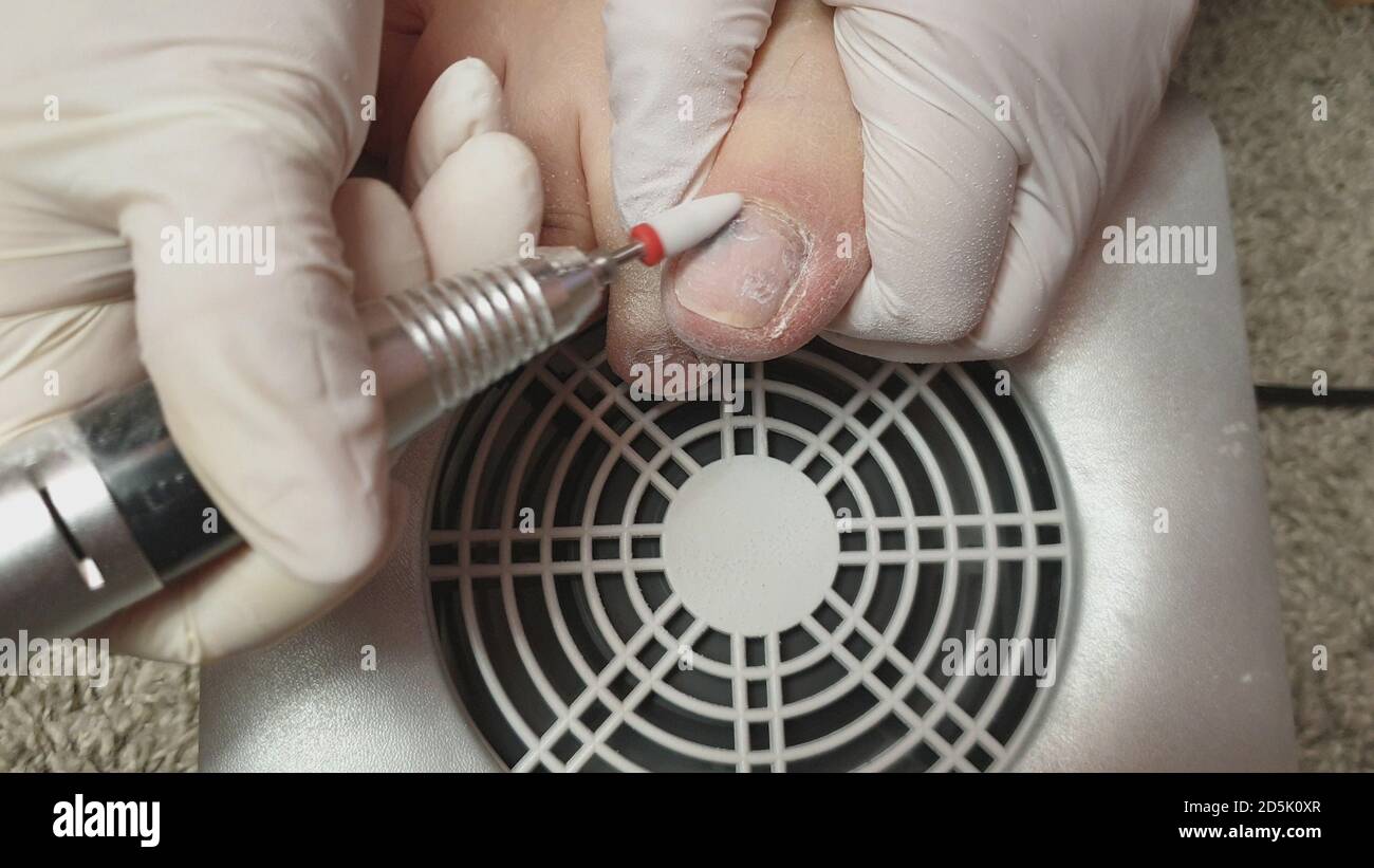 Pedicure removing gel polish from toenails stock photo alamy