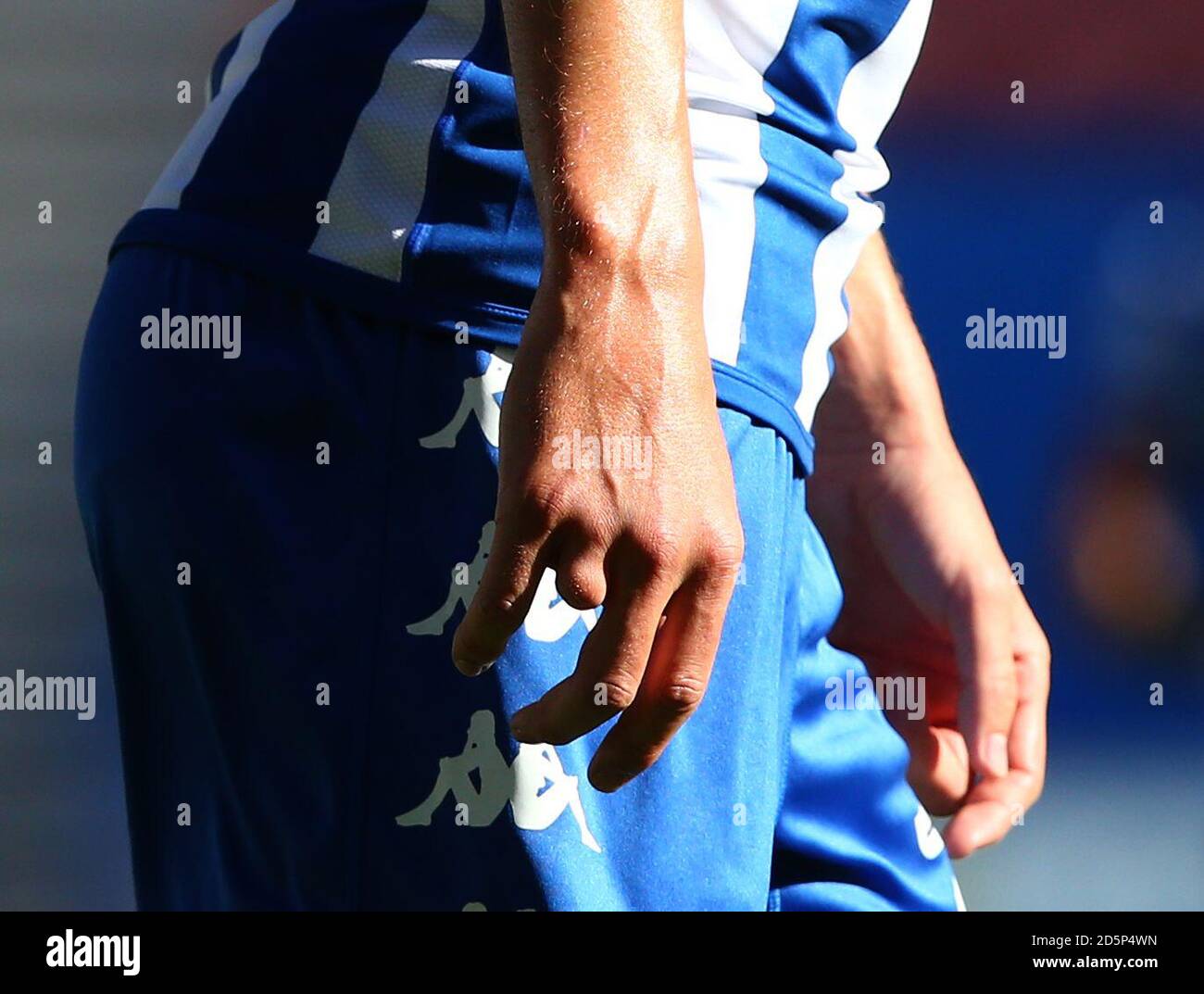Wigan Athletic's Dan Burn who has three fingers on his right hand Stock