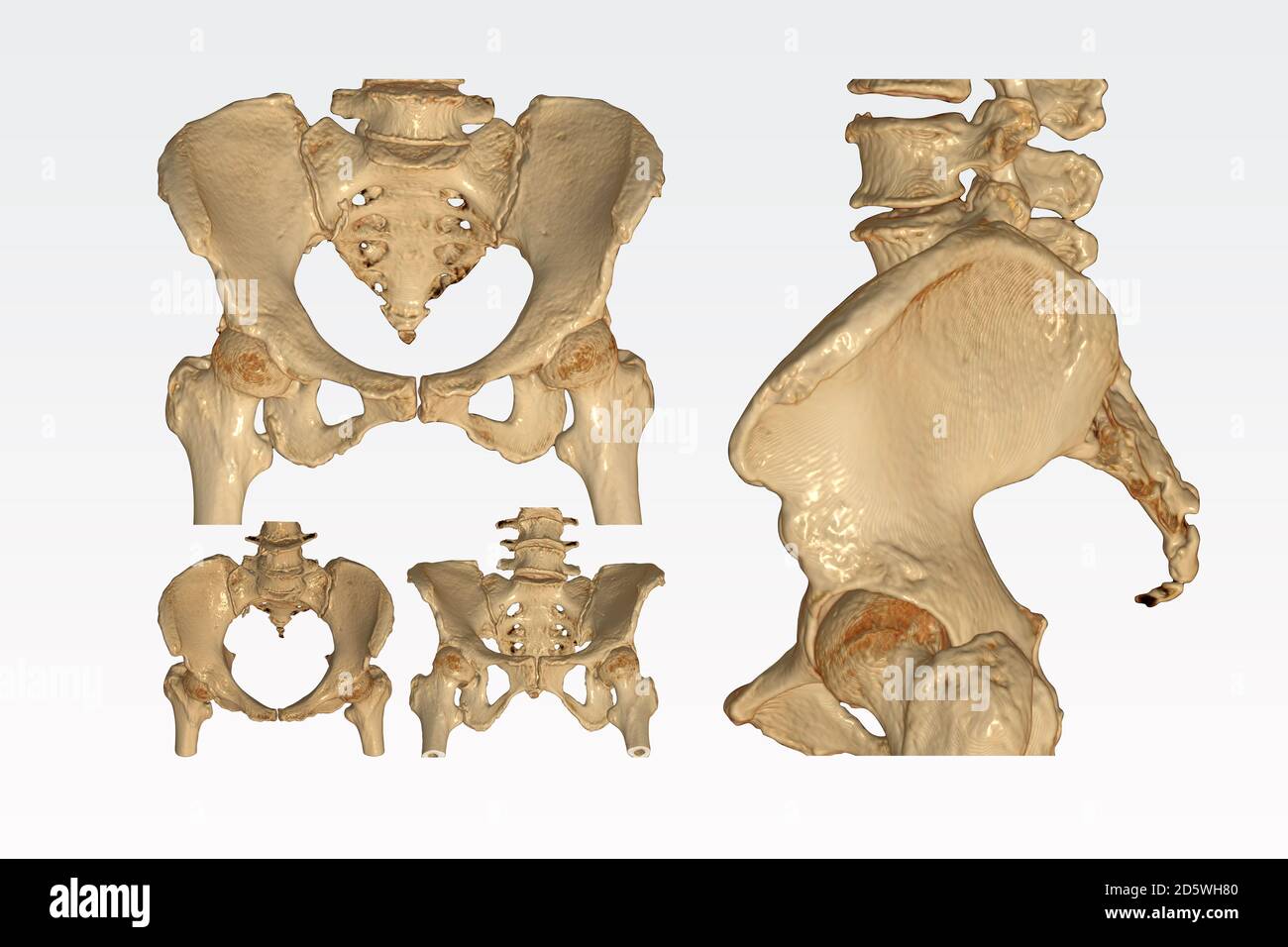 Pelvic ct hires stock photography and images Alamy