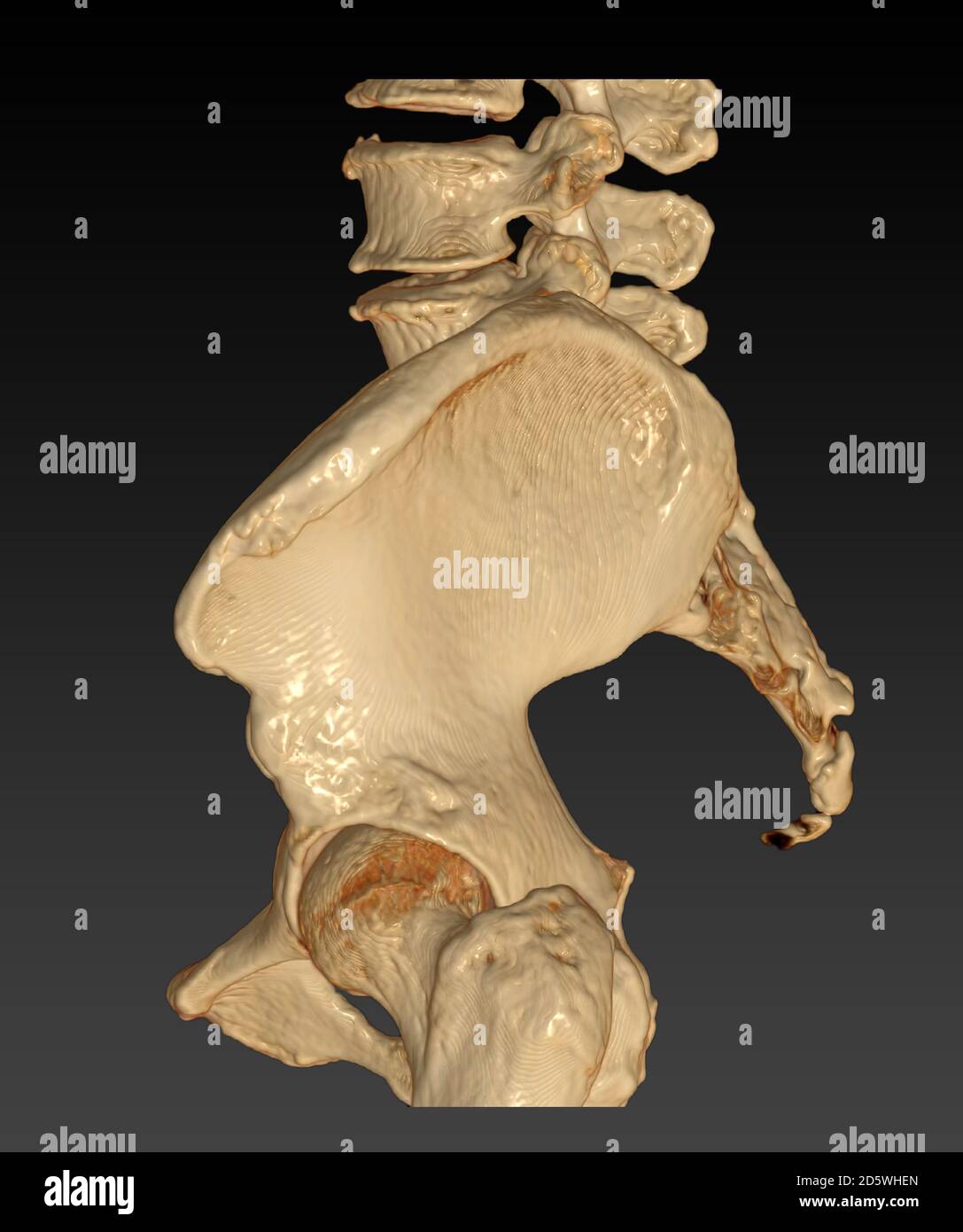 Pelvic examination hires stock photography and images Alamy