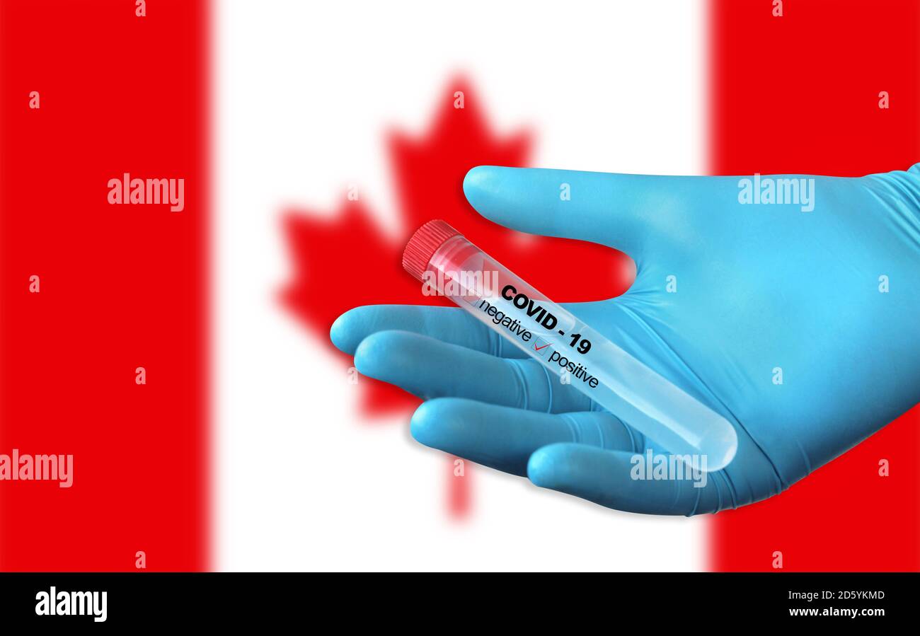 Testing for presence of coronavirus. Tube containing a swab sample that has tested positive for COVID-19. Canada flag in the background. Stock Photo