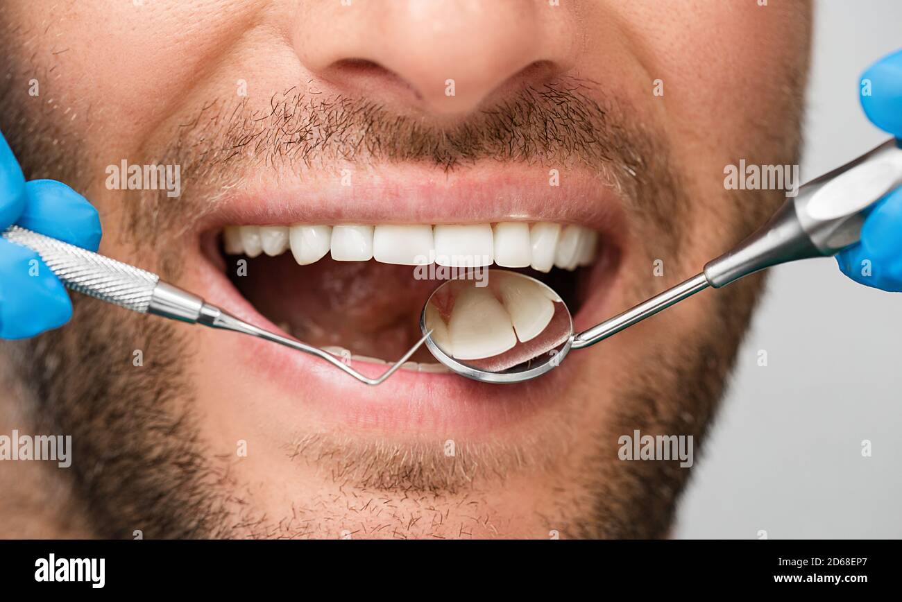 Healthy white male smile with a periodontal probe and mouth mirror, close-up. Teeth treatment. Shot part of the head Stock Photo