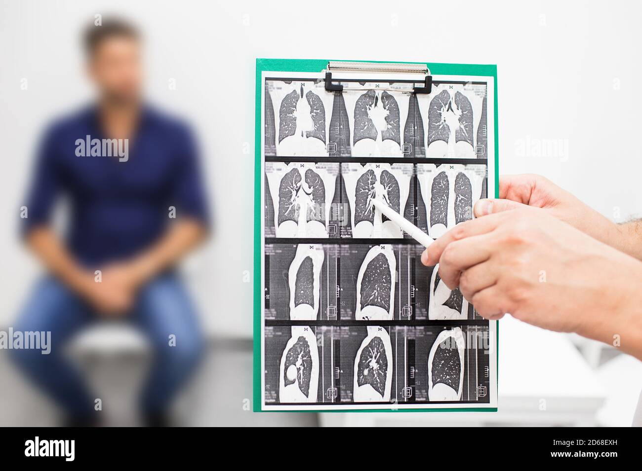 Pulmonologist showing CT scan of lungs patient with pulmonary fibrosis, after recovery, lung disease Stock Photo