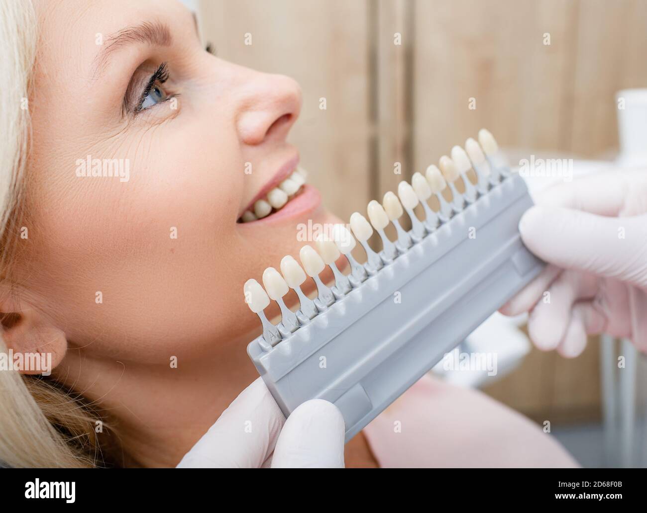 Teeth palette with different shades of teeth near female smiling