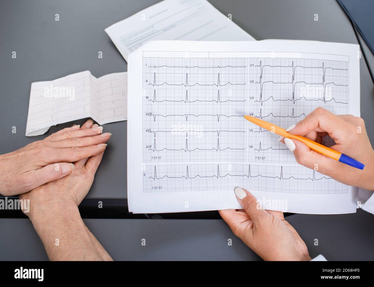 Experienced doctor holding electrocardiogram results of an elderly woman. Diagnostics and treatment of arrhythmias, coronary heart disease and heart f Stock Photo