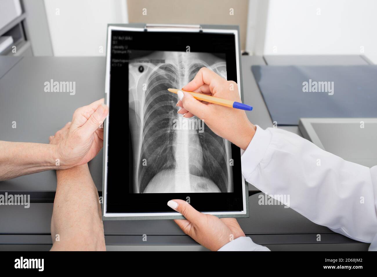 Pulmonologist showing an old patient an X-ray image of her lungs. Prevention and treatment of lung disease, pneumonia, coronavirus Stock Photo