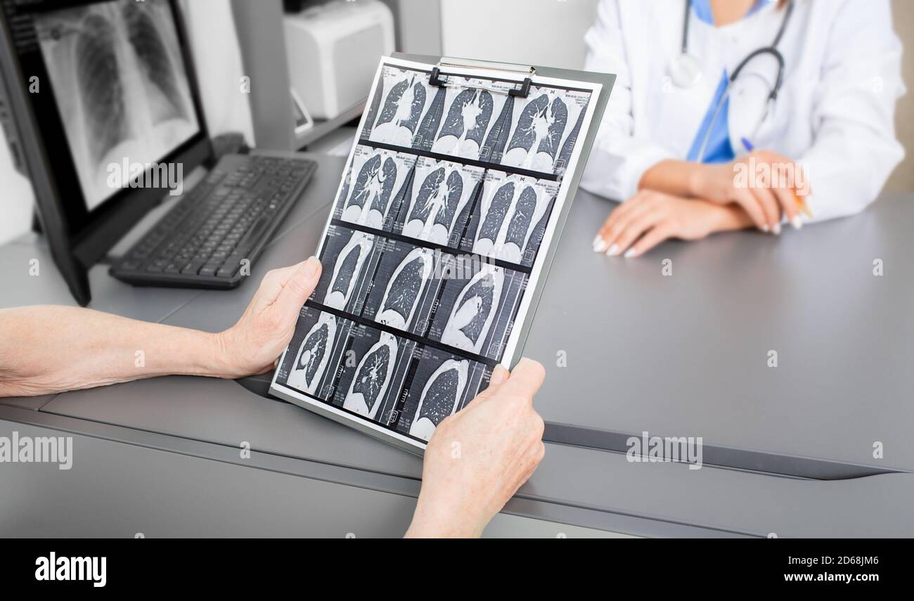Elderly patient looking at CT of her lungs. Treatment of lung inflammation, bronchitis, coronavirus, COVID 19 Stock Photo