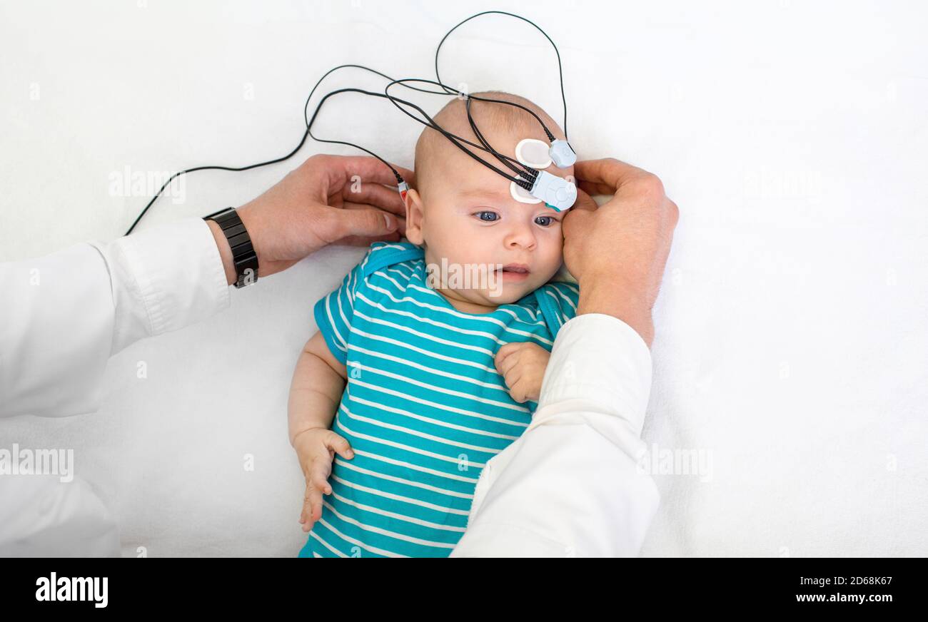 Newborn hearing screening and diagnosis at the hospital. Baby having