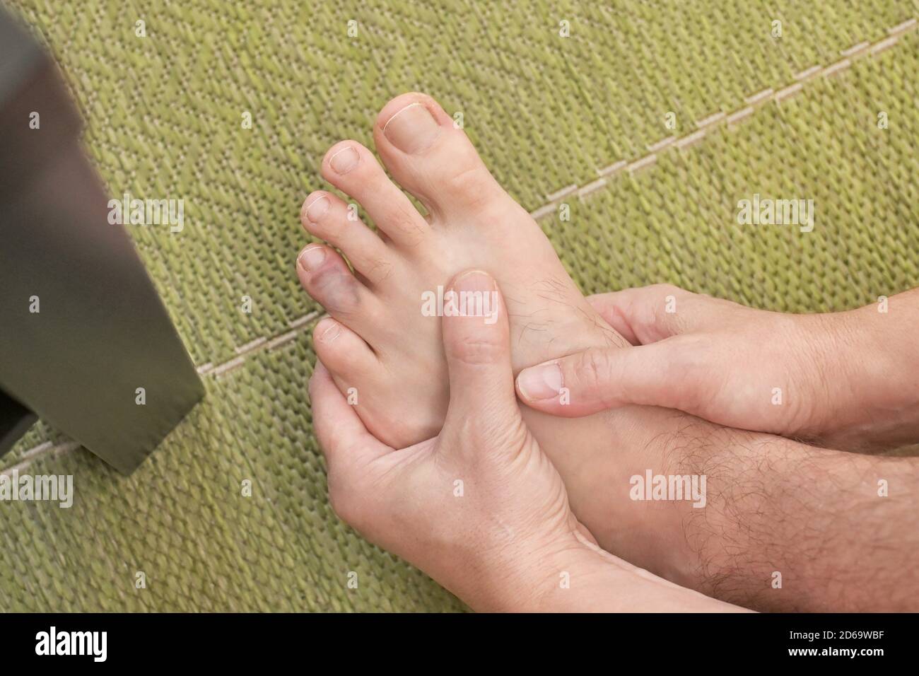 Finger man toe injured after kicking a table foot. Stock Photo