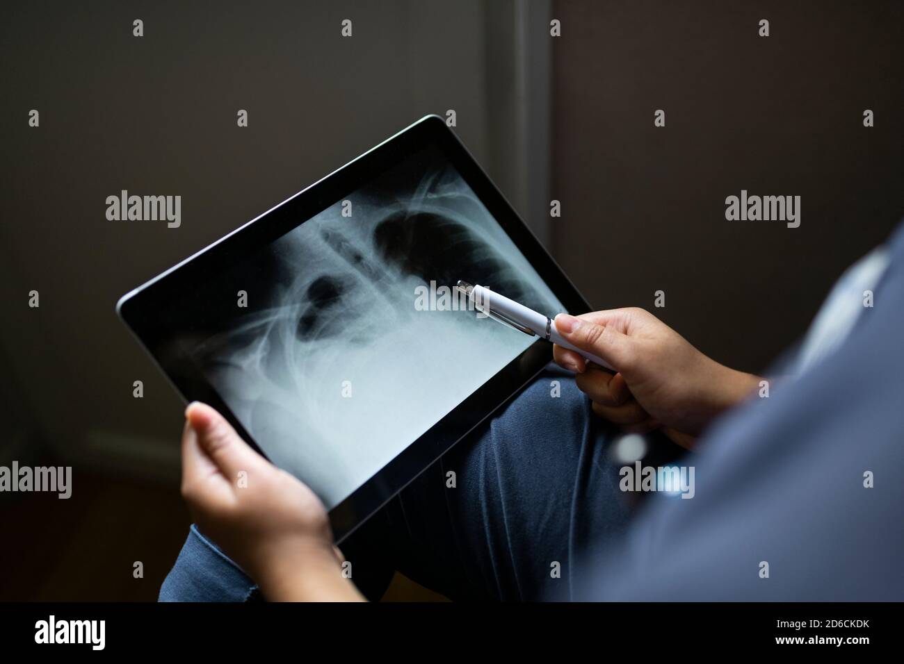 Hands holding digital tablet showing X-ray Stock Photo