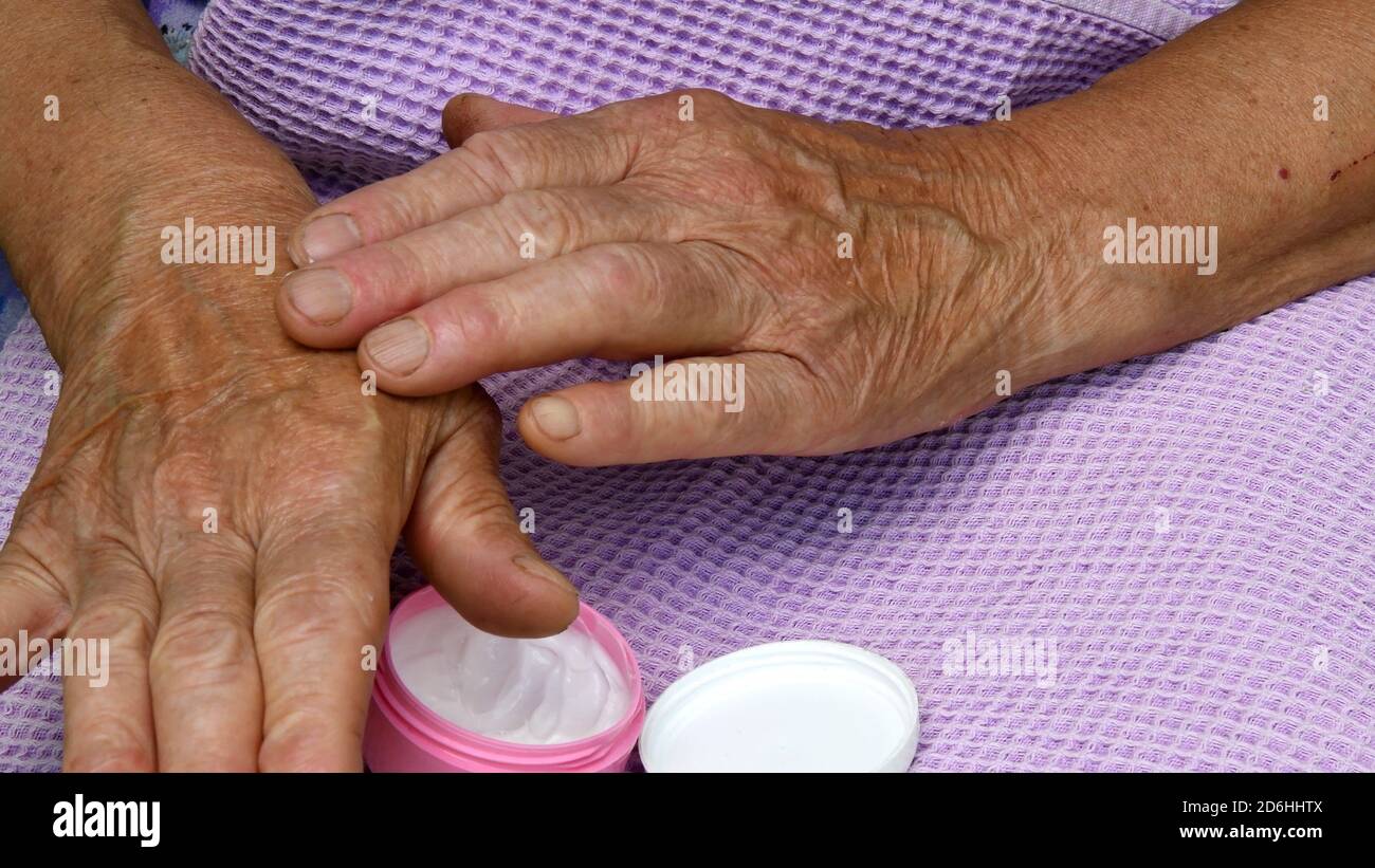 Female hands apply moisturizer cosmetic cream at her wrinkled palm skin