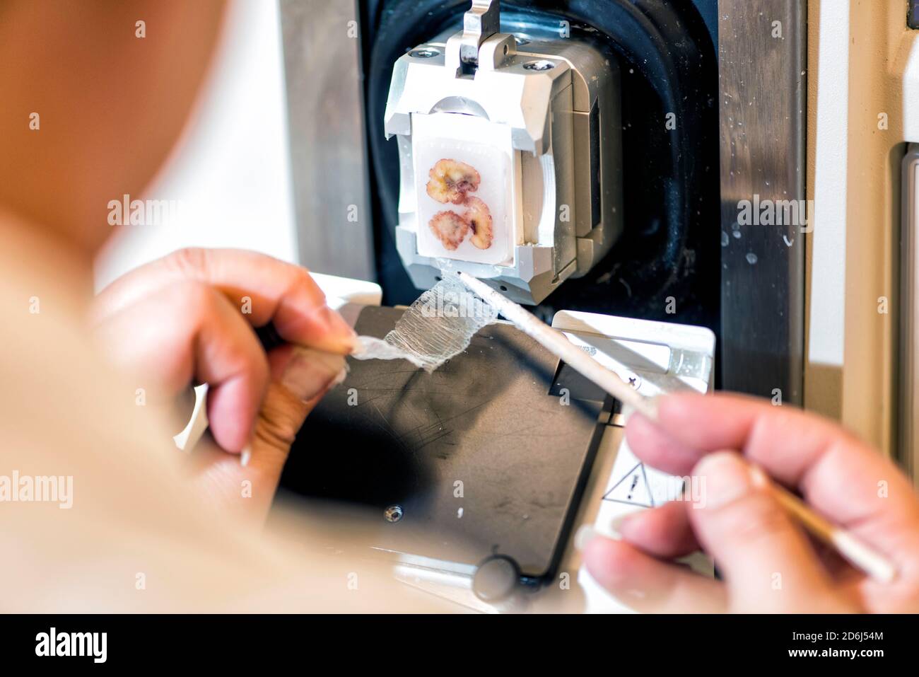 Tissue sample in the laboratory, clinical centre Stock Photo Alamy