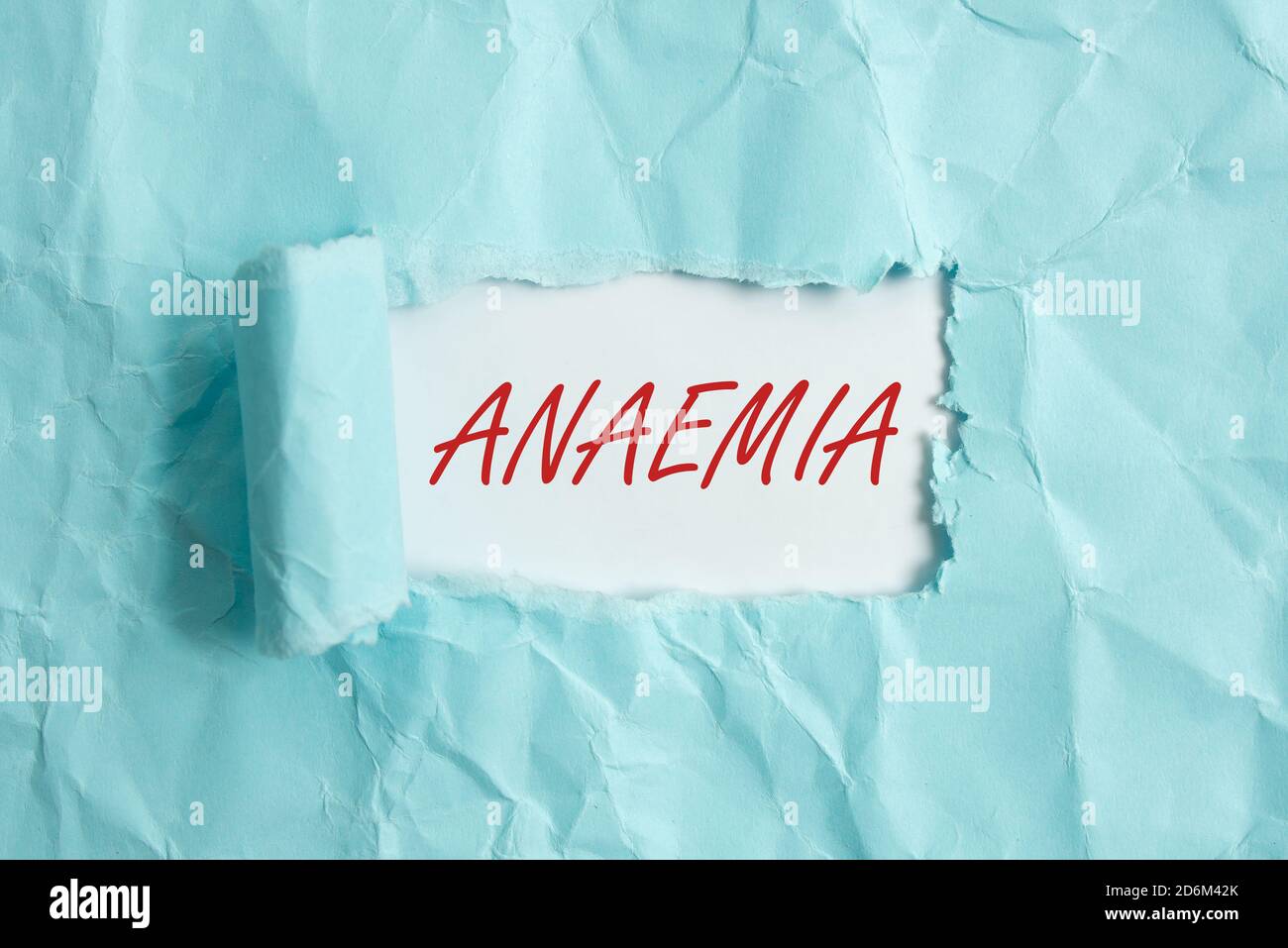 Text sign showing Anaemia. Business photo showcasing a condition marked by a deficiency of hemoglobin in the blood Rolled ripped torn cardboard placed Stock Photo