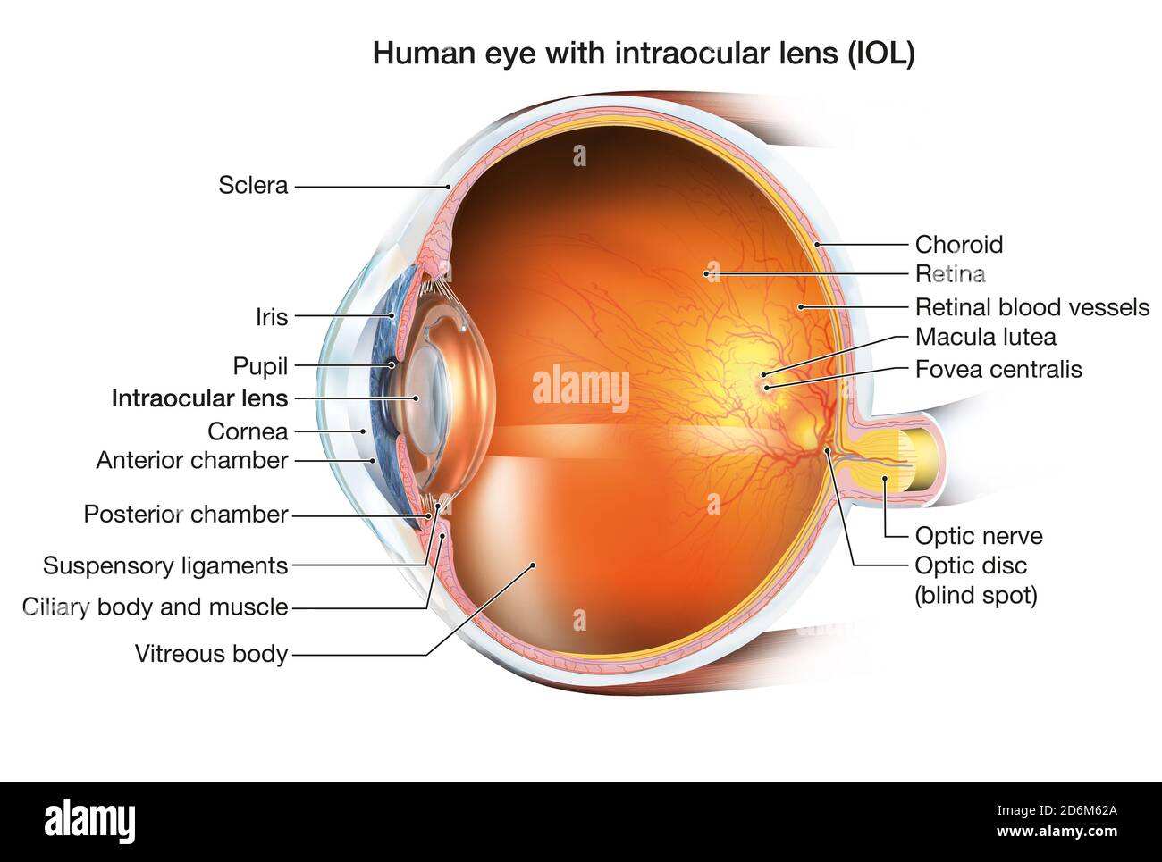 Medically 3D illustration showing human eye with intraocular lens (IOL), retina, pupil, iris, anterior chamber, posterior chamber, ciliary body, eye b Stock Photo