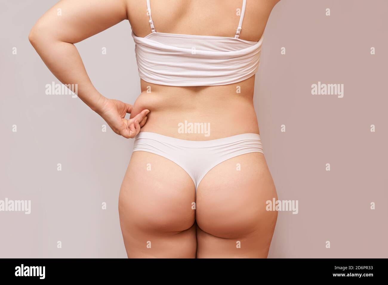 Fat unhealthy woman body. Pinch back side. Measurement lady procedure. Medicine Stock Photo