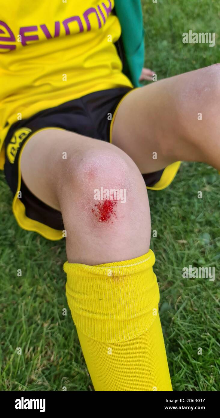 boy with tricot and scrape at the knee, Germany Stock Photo