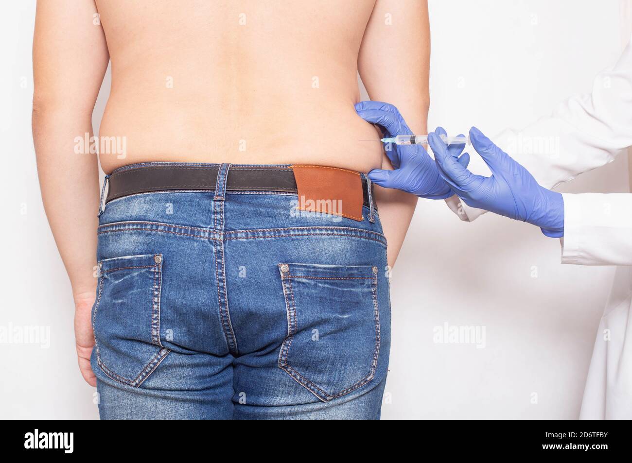 The doctor gives a subcutaneous injection to break down fat deposits on the sides of a man, metabolism Stock Photo