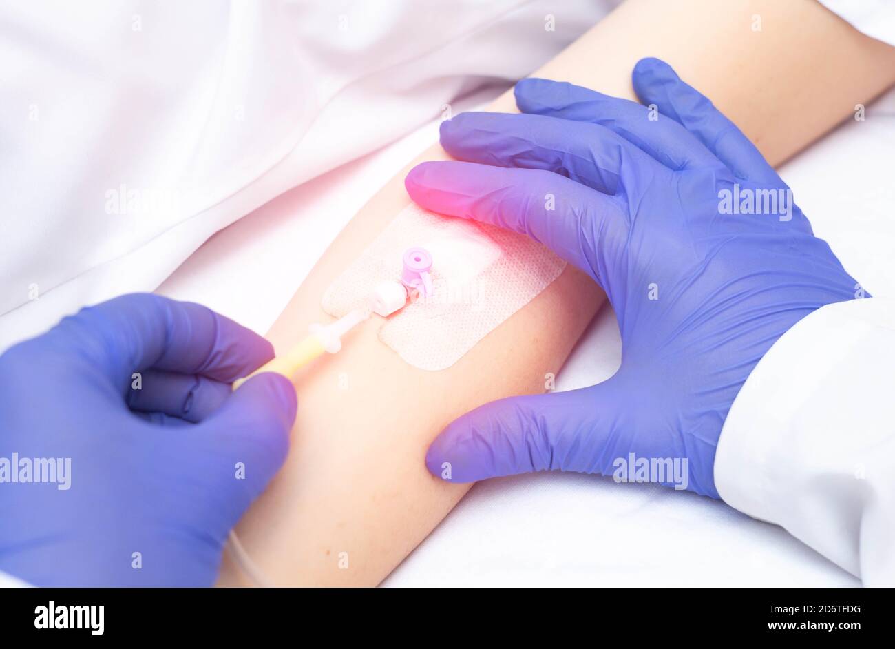 Doctor inserting an intravenous catheter for blood transfusion into a