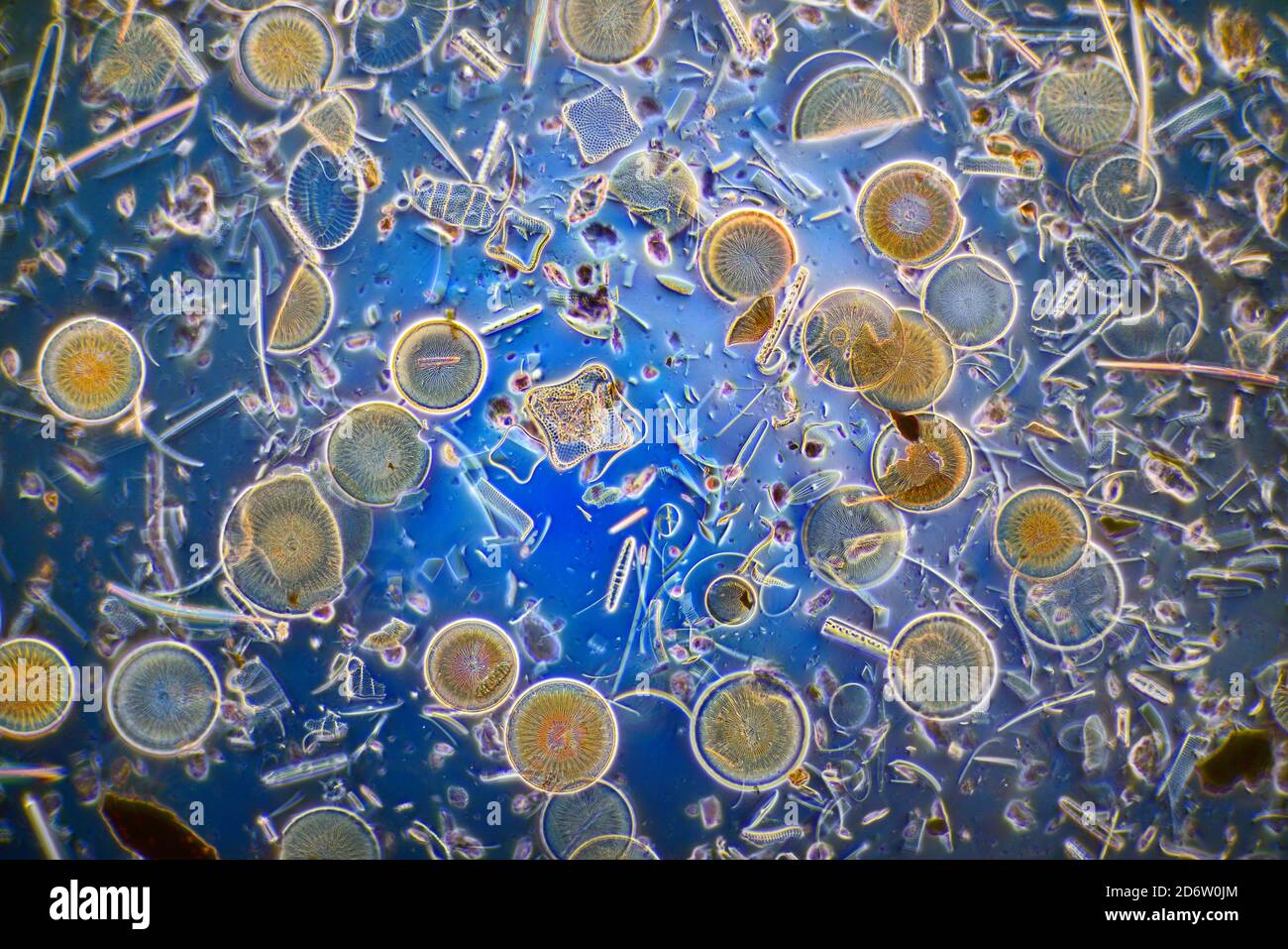 Strewn diatoms including Eupodiscus ralfsii Stock Photo Alamy