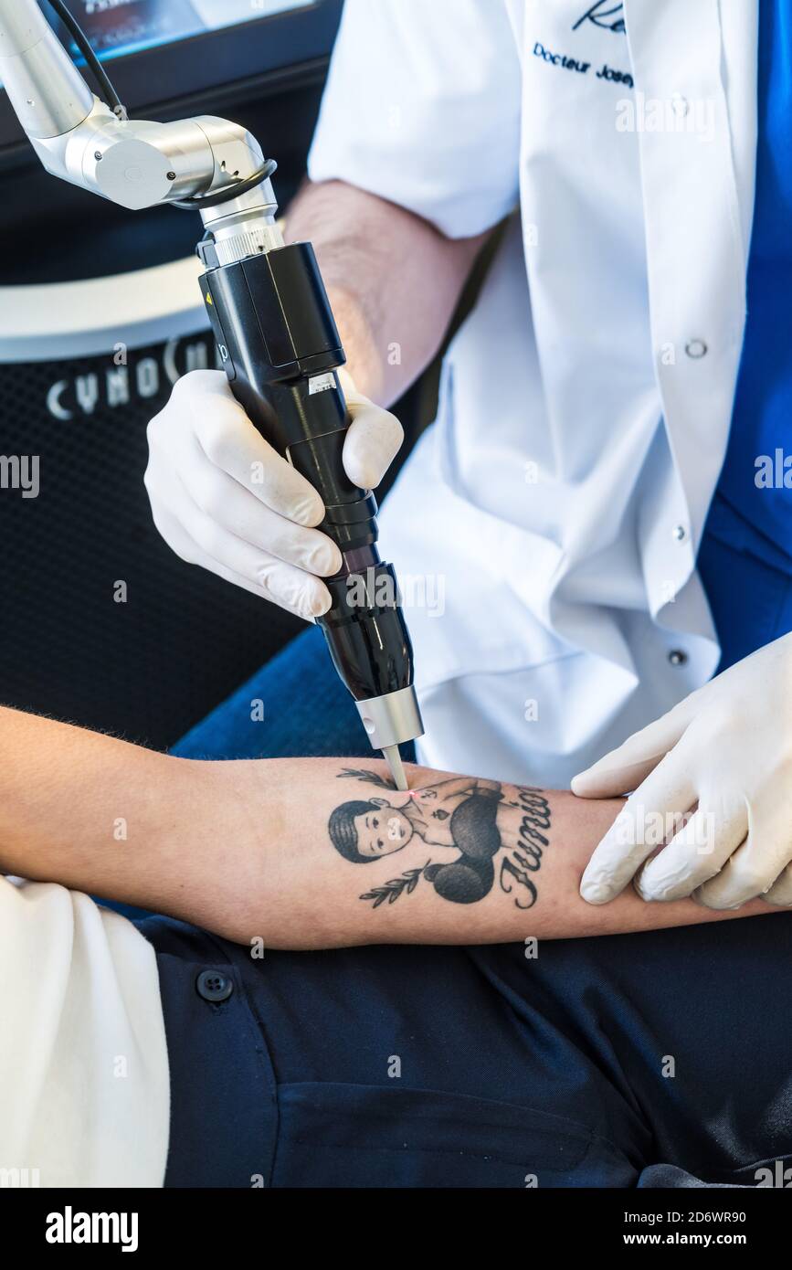 Picosecond laser used for tattoo removal, Center Cosem Paris Stock Photo -  Alamy