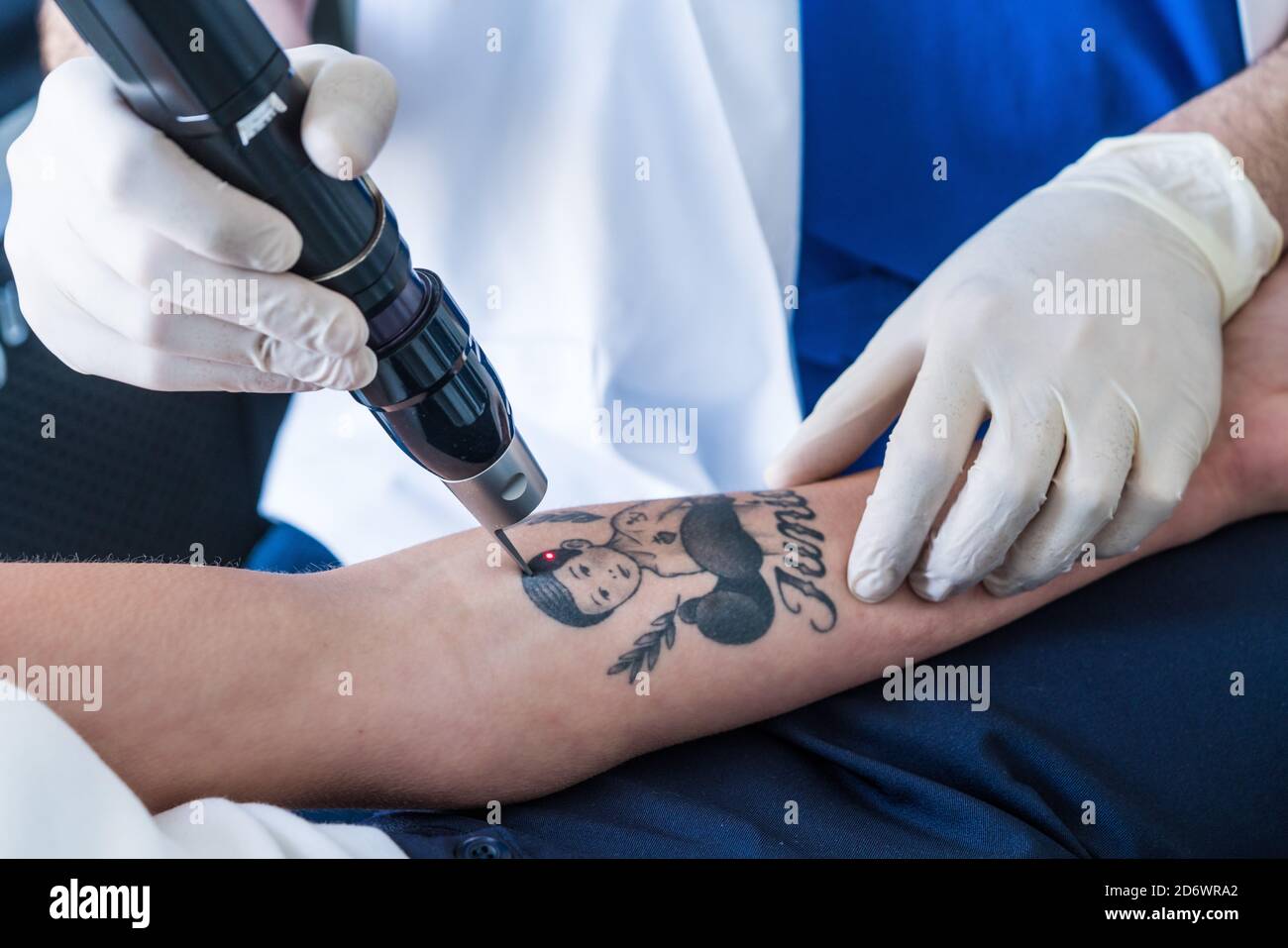 Tips for Summer Tattoo Removal  Callender Dermatology  Cosmetic Center