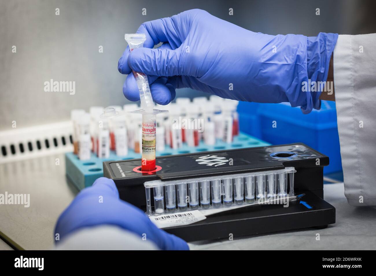 Processing of BioFire ® FilmArray tests. This test provides reliable results for the identification of 23 targets (viruses and bacteria) responsible f Stock Photo